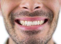 clareamento-dental-e-outras-formas-de-manter-os-dentes-mais-brancos